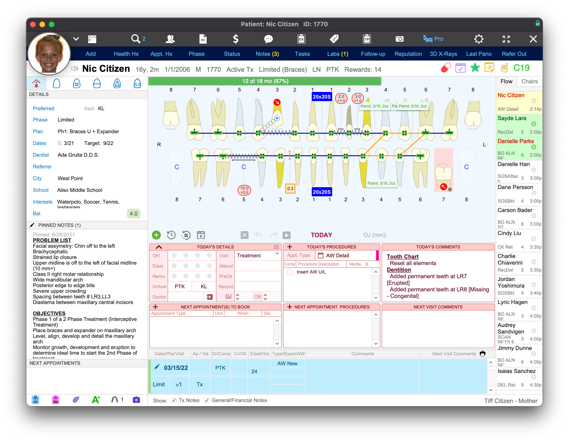 A screenshot of the WaveOrtho Treatment Card Pro, featuring a packed list of components to use, a tooth chart and additional tooling related to the daily visit for the patient